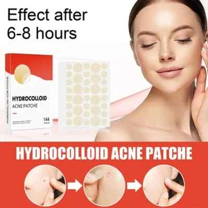 144 PCS Hydrocolloid Pimple Patches for Face - Acne Spot Treatment, Fast Healing - Picture 1 of 7