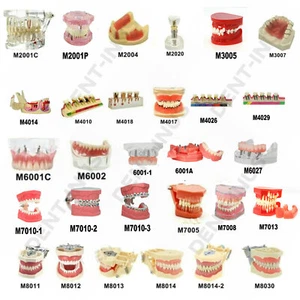 Teeth Model Dental Typodont Ortho Implant Pathological Perio Practice Demo Model - Picture 1 of 101