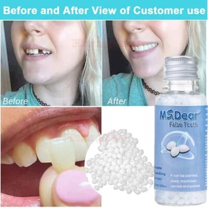 Temporary Teeth Tooth Repair Strong Dental Cement Cavity Filling Kit Fake Teeth - Picture 1 of 15