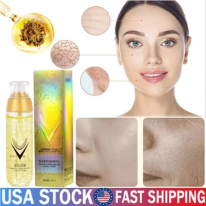 Remove Wrinkles in Seconds Ecdoin Anti-Aging Essence, Ecdoin Anti Aging Serum - Picture 1 of 26