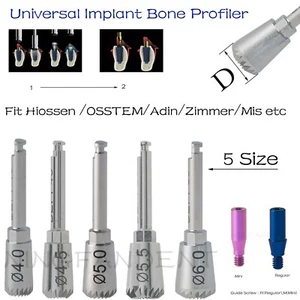 Universal Hiossen Adin Zimmer Fehlimplantatsystem Knochenprofiler & Führungsschraubenset - Bild 1 von 76