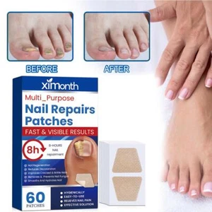 60x Anti Fungal Nail Treatment Patches Toe Fungus Onychomycosis Repair Sticker - Picture 1 of 12