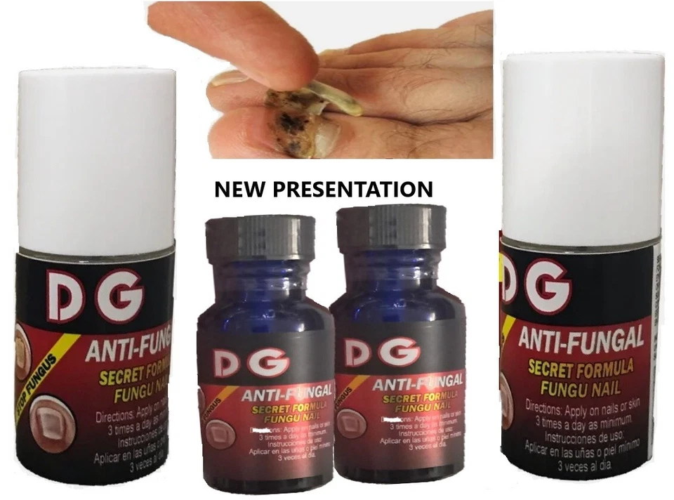 ANTIFÚNGICOS MÁXIMA FUERZA UÑAS HONGOS ATLETAS PIE HONGOS UÑAS SOPORTE 2 Foto 1 de 1