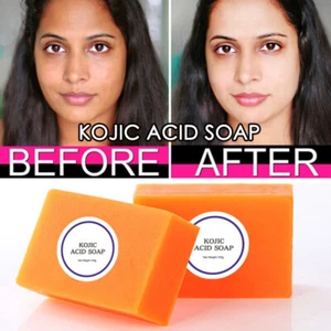 Kojic Acid Kojie Soap Dark Skin Whitening Bleaching Lightening Brightening San