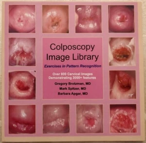 Colposcopy Image Library : Exercises in Pattern Recognition - Picture 1 of 3