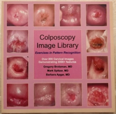 Colposcopy Image Library : Exercises in Pattern Recognition - Image 1 of 3