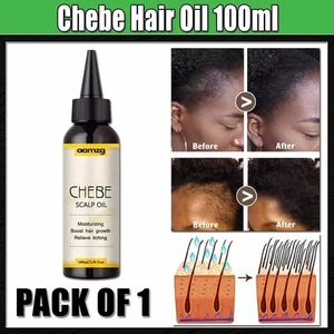 New Chebe Hair Growth & Scalp Oil Anti Hair Loss & Strengthening Formula - 100ml - Picture 1 of 9