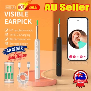 Wireless Ear Wax Remover Camera HD Endoscope Spoon Pick Cleaning Otoscope ToolQT - Picture 1 of 22