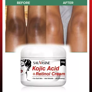 ✅ Piel oscura, crema blanqueadora blanqueadora aclaradora cuidado retinol rostro y cuerpo - Imagen 1 de 10