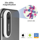 Objectif microscope mobile de poche pour téléphone 20x-400x grossissement jouet éducatif