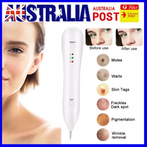Laser Freckle Removal Machine Skin Mole Dark Spot Face Wart Tag Remover Pen - Picture 1 of 12