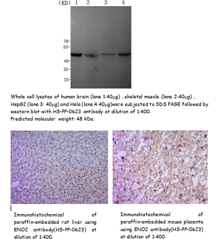 兔子抗人类 ENO2 多克隆抗体,100uL,www.sunnybiotechnology.com  — 第 1/1 张图片