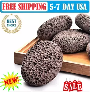 Pumice Stone for Feet - Food File - Callus - Corn Remover - Skin Scrubber - Picture 1 of 6