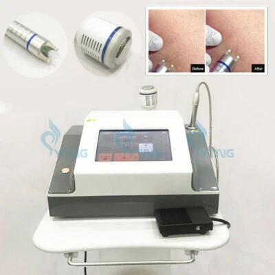 980nm diode laser Red Blood Vessel Vascular Removal Beauty Machine cold hammer - Image 1 of 4