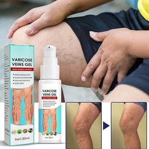 2023 Nuevo Gel Tratamiento VeinPure, Elimina Crema para Varices - Imagen 1 de 9