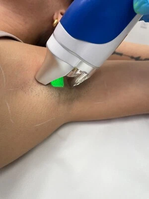 Splendor X Foto 1 de 4