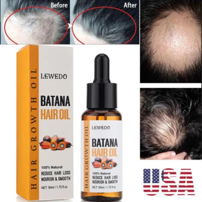 Aceite de Batana 50 ml para un crecimiento saludable del cabello anti-pérdida de cabello reparación de raíces de cabello dañado Foto 1 de 4