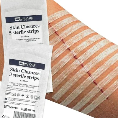 STERILE SKIN CLOSURE STRIPS Butterfly/Steri Cut Support Stitches 3mm/6mm x 75mm - Image 1 of 3