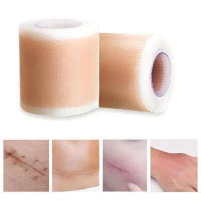 🔥Scar Silicone Sheet Gel Patch Removal Skin Treatment Burn Repair W - Image 1 of 4