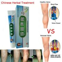 Crema Para Eliminar Las Varices Y Arañitas Vasculares Ebay