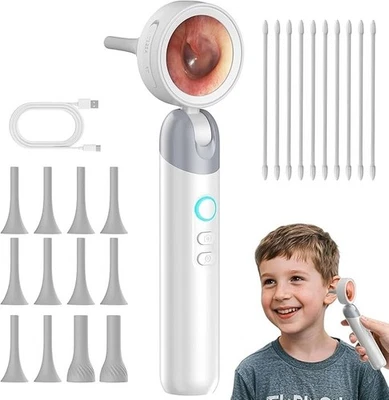 Cámara Otoscopio Digital EartoYou con Pantalla HD - Pantalla Plegable 90°, 3.6mm Le Foto 1 de 4