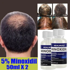Minoxidil 5% Hair Regrowth Treatment 50ml Topical Solution Men 2 MONTHS SUPPLY - Picture 1 of 18