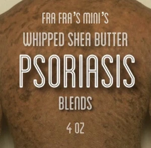 Fra Fra's Mini's Premium Healing Psoriasis Organic Liquid Black Soap Blend 4 oz - Picture 1 of 4