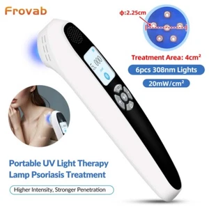 308nm UV Excimer Light Therapy Device for Plaques & Atopic Dermatitis 20mW/cm² - Picture 1 of 23
