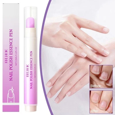 3 in 1 Nail Essence Pen Nail Cuticle Oil Moisturizing Pen, Cuticle Remover T3L1 - Image 1 of 4