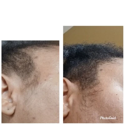 Organic  Hair Growth Oil Serum DHT-Alopecia-Thinning Hair-Balding (60ml) 2 oz. - Image 1 of 4