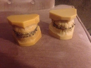 Braces Dental Models For Dental Hygiene Demonstration - Picture 1 of 5