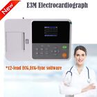 CONTEC Digital ECG Monitor Electrocardiograph 1 Channel EKG Machine 12 Lead