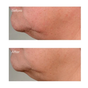 High Potency Growth Factor Firming & Lifting Serum, 2 Fl. Oz. - Picture 1 of 5
