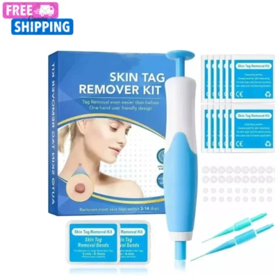 Natural Painless Auto SKIN TAG Removal Kit Skin Tag Micro Bands Remover Device