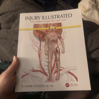 Injury Illustrated: How Medical Images Win Legal Cases - Image 1 of 4