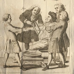 Amputation Surgery & Instruments c.1760 Series of 17 Engravings  Benjamin Martin - Picture 1 of 11