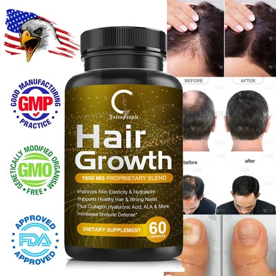 Advanced Anti Hair Loss Capsules DHT Blocker Fast Hair Growth Vitamins Pills - Bild 1 von 4