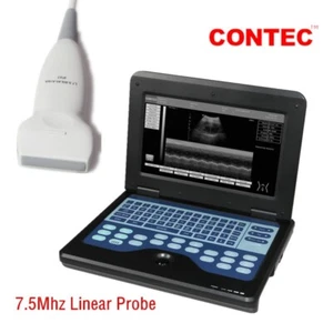 CMS600P2 Laptop Ultrasound Scanner Diagnostic Machine with 7.5Mhz Linear Probe - Picture 1 of 16
