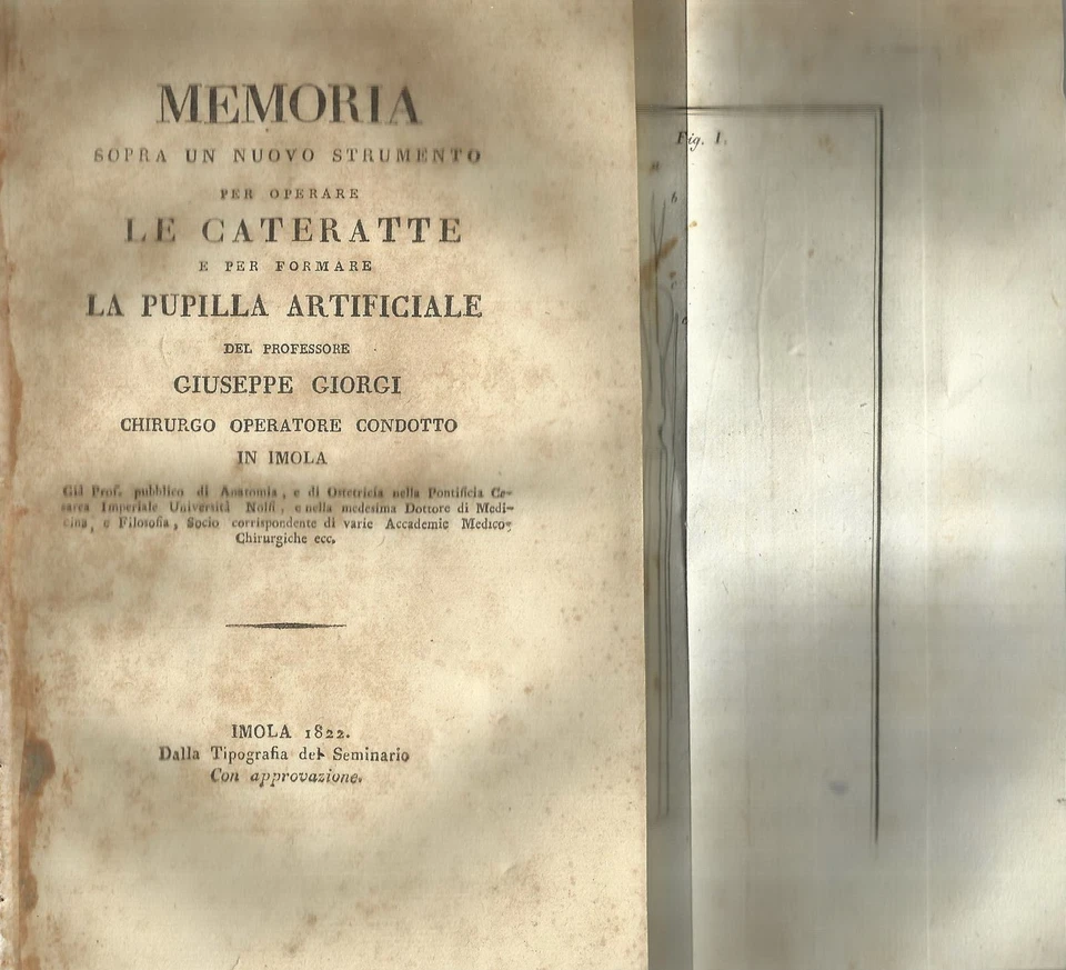 MEDICINA_CHIRURGIA_OCULISTICA_CATARATTA_PUPILLE ARTIFICIALI_IMOLA_MARCHE_UMBRIA - Immagine 1 di 1