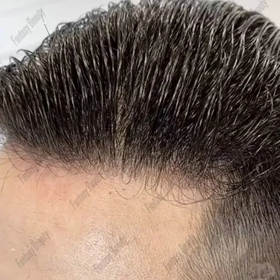 Super Natural Hairline 80Density 0.02mm Ultra Thin Skin Undetectable Vloop Men - Image 1 of 4