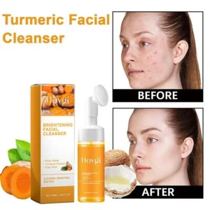 Detergente Viso alla Curcuma, Lavaggio Viso alla Curcuma, Detergente Schiumogeno alla Curcuma K3C0 - Foto 1 di 13