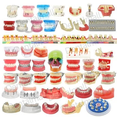 Зубной Typodont Модель Зубов Overdenture Имплантат Практика Endo Ortho Teachi Исследование - Изображение 1 из 4