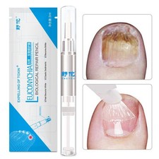 Nail Fungus Treatment Nail Oil Pen 3Ml Anti Fungal Nail Cuticle Remover Liquid